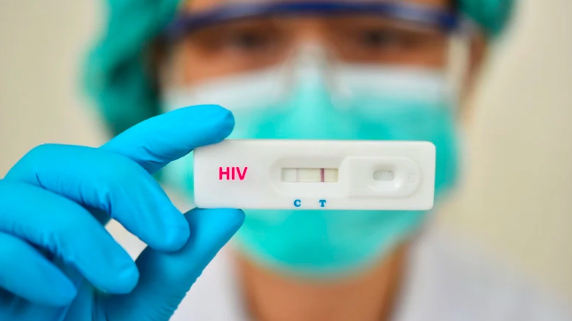 JUST IN: Over 30 new cases of HIV/Aids recorded in SVG – One News SVG